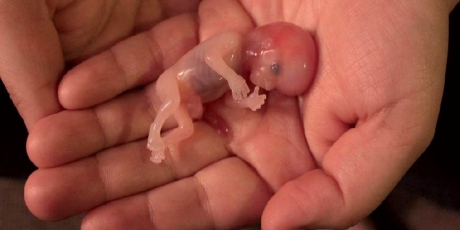 Foetus-de-12-semaines.jpg