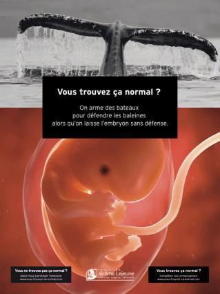 fondation-Lejeune-contre-avortement.jpg